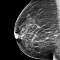 Премиальная  система рентгенографическая цифровая для маммографии Brestige Expert Indirect 8кВт